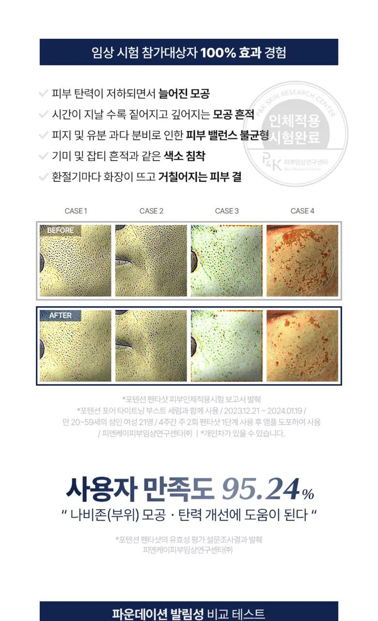[7중모공케어] 셀로라바이 펜타샷 [기획세트(+모공세럼30ml+파우치)/단품] 상세페이지 14